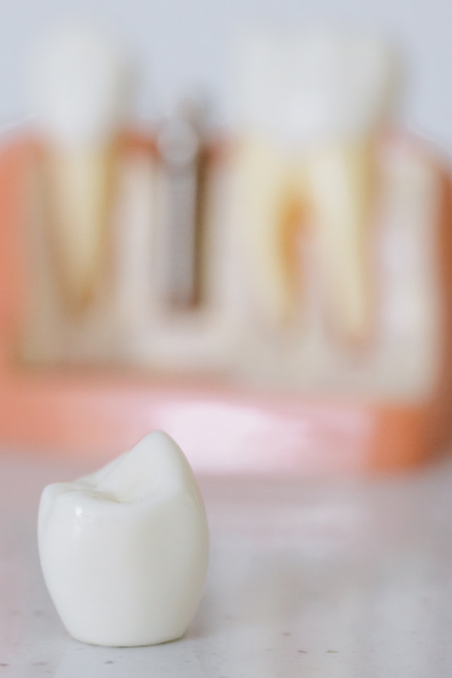 Coronas dentales Dentharmony