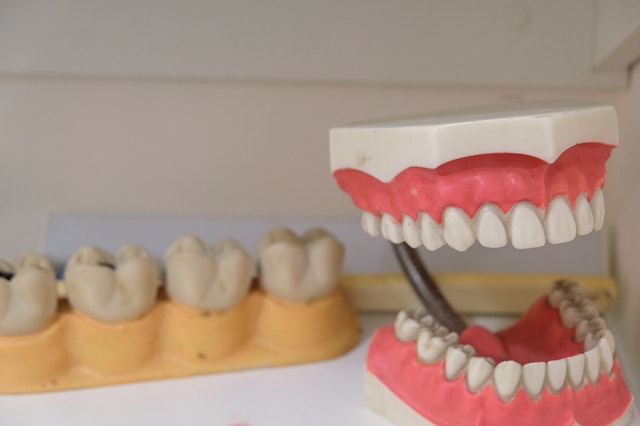 Placas Dentales Dentharmony